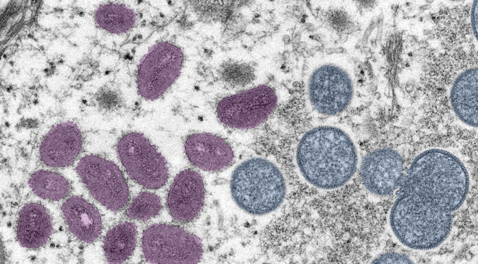 Monterey Countyās first probable case of monkeypox detected