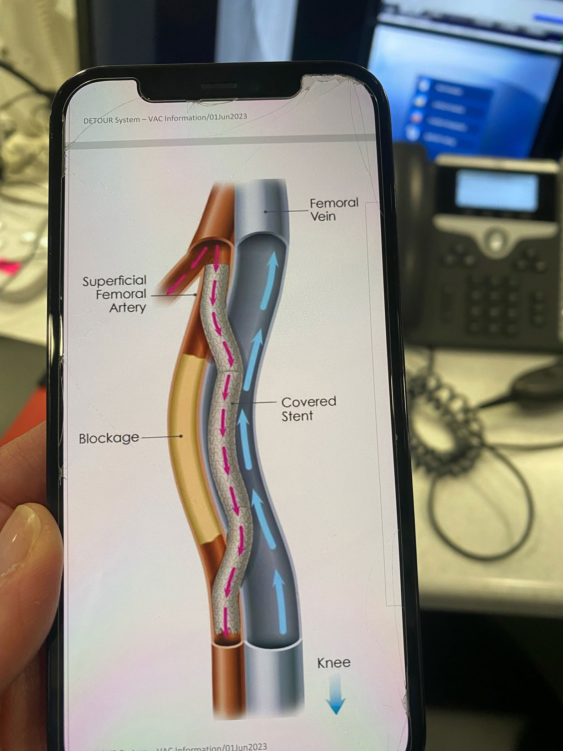 Salinas Valley Health cath lab makes history Salinas Valley Tribune Gonzales, Soledad